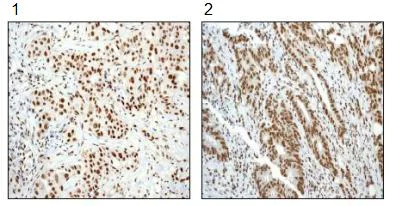 Immunohistochemistry (Formalin/PFA-fixed paraffin-embedded sections) - Anti-SMAD1 + SMAD5 + SMAD9 (phospho S463 + S465 + S467) antibody [MMC-1-104-3] (AB92698)