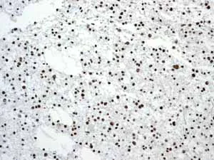 Immunohistochemistry (Formalin/PFA-fixed paraffin-embedded sections) - Anti-SMAD1 + SMAD5 + SMAD9 (phospho S463 + S465 + S467) antibody [MMC-1-104-3] (AB92698)