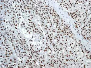 Immunohistochemistry (Formalin/PFA-fixed paraffin-embedded sections) - Anti-SMAD1 + SMAD5 + SMAD9 (phospho S463 + S465 + S467) antibody [MMC-1-104-3] (AB92698)