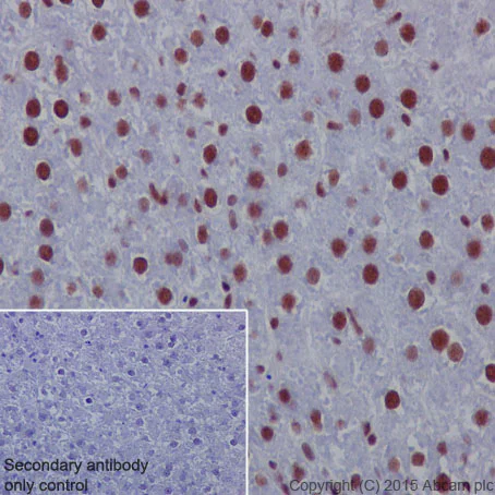 Immunohistochemistry (Formalin/PFA-fixed paraffin-embedded sections) - Anti-SMAD1 + SMAD5 + SMAD9 (phospho S463 + S465 + S467) antibody [MMC-1-104-3] (AB92698)