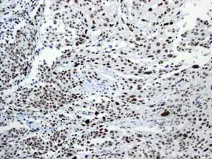 Immunohistochemistry (Formalin/PFA-fixed paraffin-embedded sections) - Anti-SMAD1 + SMAD5 + SMAD9 (phospho S463 + S465 + S467) antibody [MMC-1-104-3] (AB92698)