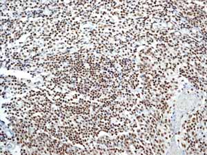 Immunohistochemistry (Formalin/PFA-fixed paraffin-embedded sections) - Anti-SMAD1 + SMAD5 + SMAD9 (phospho S463 + S465 + S467) antibody [MMC-1-104-3] (AB92698)