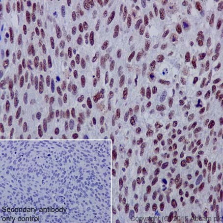 Immunohistochemistry (Formalin/PFA-fixed paraffin-embedded sections) - Anti-SMAD1 + SMAD5 + SMAD9 (phospho S463 + S465 + S467) antibody [MMC-1-104-3] (AB92698)