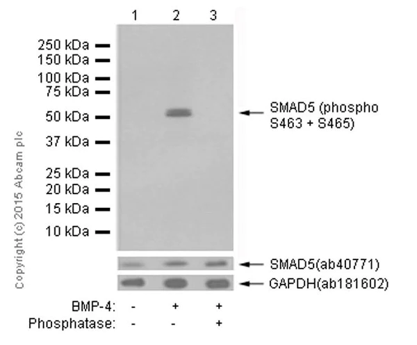 Western blot - Anti-SMAD1 + SMAD5 + SMAD9 (phospho S463 + S465 + S467) antibody [MMC-1-104-3] (AB92698)