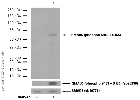 Western blot - Anti-SMAD1 + SMAD5 + SMAD9 (phospho S463 + S465 + S467) antibody [MMC-1-104-3] (AB92698)
