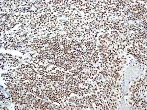 Immunohistochemistry (Formalin/PFA-fixed paraffin-embedded sections) - Anti-SMAD1 + SMAD5 + SMAD9 (phospho S463 + S465 + S467) antibody [MMC-1-104-3] - BSA and Azide free (AB168252)