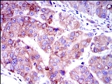 Immunohistochemistry (Formalin/PFA-fixed paraffin-embedded sections) - Anti-Smad2 antibody [5G7] (AB119907)