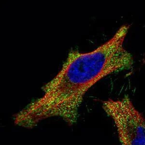Immunocytochemistry/ Immunofluorescence - Anti-Smad2 antibody (AB228765)