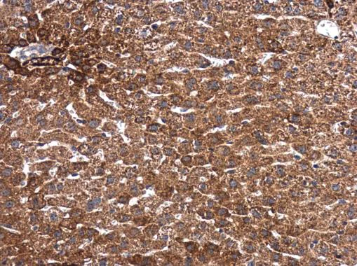 Immunohistochemistry (Formalin/PFA-fixed paraffin-embedded sections) - Anti-Smad2 antibody (AB228765)