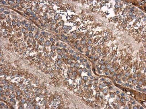 Immunohistochemistry (Formalin/PFA-fixed paraffin-embedded sections) - Anti-Smad2 antibody (AB228765)