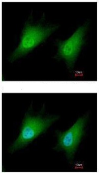 Immunocytochemistry/ Immunofluorescence - Anti-Smad2 antibody (AB228807)