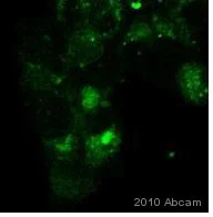 Immunocytochemistry/ Immunofluorescence - Anti-Smad2 antibody (AB63576)