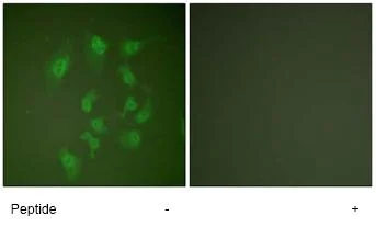 Immunocytochemistry/ Immunofluorescence - Anti-Smad2 antibody (AB63576)