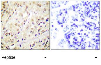 Immunohistochemistry (Formalin/PFA-fixed paraffin-embedded sections) - Anti-Smad2 antibody (AB63576)