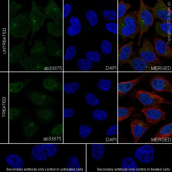 Immunocytochemistry/ Immunofluorescence - Anti-Smad2 antibody [EP567Y] (AB33875)