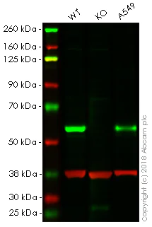 Western blot - Anti-Smad2 antibody [EP567Y] (AB33875)