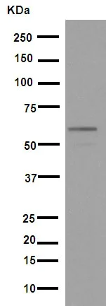 Western blot - Anti-Smad2 antibody [EP567Y] (AB33875)