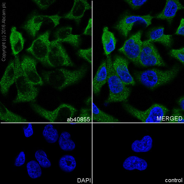 Immunocytochemistry/ Immunofluorescence - Anti-Smad2 antibody [EP784Y] (ab40855), expandable thumbnail