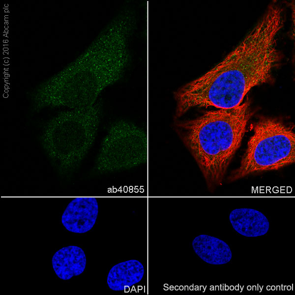 Immunocytochemistry/ Immunofluorescence - Anti-Smad2 antibody [EP784Y] (ab40855), expandable thumbnail