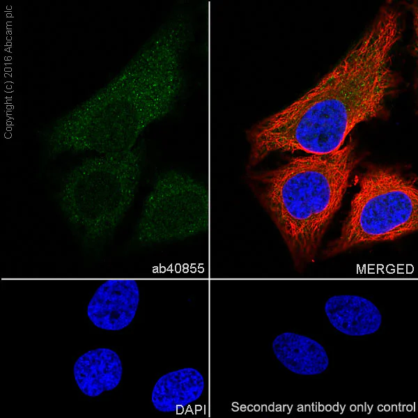 Immunocytochemistry/ Immunofluorescence - Anti-Smad2 antibody [EP784Y] (AB40855)