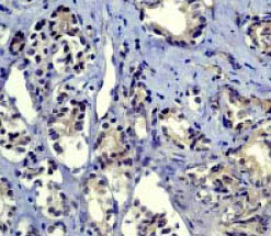Immunohistochemistry (Formalin/PFA-fixed paraffin-embedded sections) - Anti-Smad2 antibody [EP784Y] (AB40855)