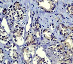 Immunohistochemistry (Formalin/PFA-fixed paraffin-embedded sections) - Anti-Smad2 antibody [EP784Y] (AB40855)