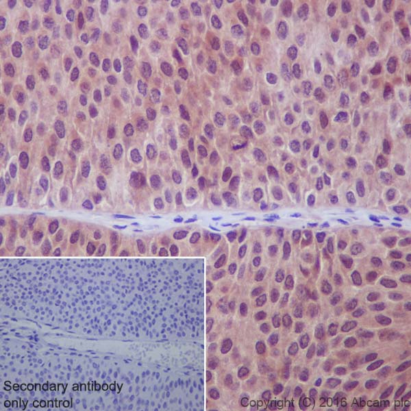 Immunohistochemistry (Formalin/PFA-fixed paraffin-embedded sections) - Anti-Smad2 antibody [EP784Y] (ab40855), expandable thumbnail
