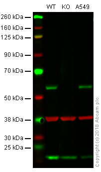Western blot - Anti-Smad2 antibody [EP784Y] (AB40855), expandable thumbnail