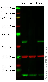 Western blot - Anti-Smad2 antibody [EP784Y] (AB40855)