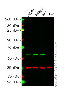 Western blot - Anti-Smad2 antibody [EP784Y] (AB40855), expandable thumbnail