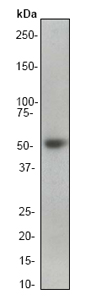 Western blot - Anti-Smad2 antibody [EP784Y] (ab40855), expandable thumbnail
