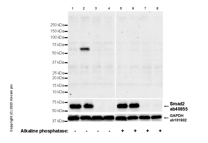 Western blot - Anti-Smad2 antibody [EP784Y] (ab40855), expandable thumbnail