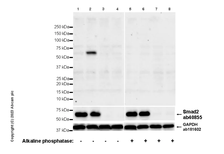 Western blot - Anti-Smad2 antibody [EP784Y] (AB40855)