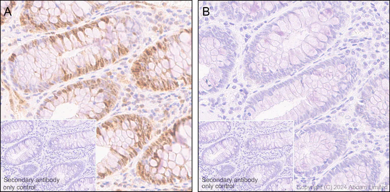 Immunohistochemistry (Formalin/PFA-fixed paraffin-embedded sections) - Anti-Smad2 (phospho S250) antibody [EPR2855(2)] (AB184557)