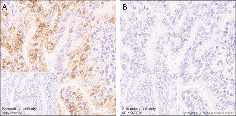 Immunohistochemistry (Formalin/PFA-fixed paraffin-embedded sections) - Anti-Smad2 (phospho S250) antibody [EPR2855(2)] (AB184557)