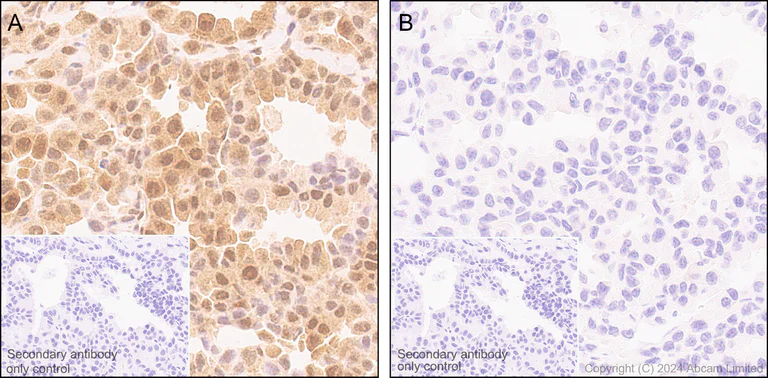 Immunohistochemistry (Formalin/PFA-fixed paraffin-embedded sections) - Anti-Smad2 (phospho S250) antibody [EPR2855(2)] (AB184557)
