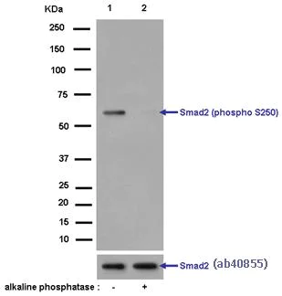 Western blot - Anti-Smad2 (phospho S250) antibody [EPR2855(2)] (AB184557)