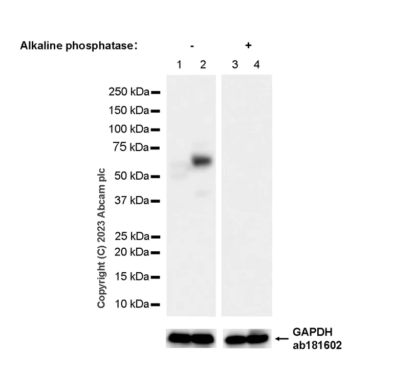 Western blot - Anti-Smad2 (phospho S250) antibody [EPR2855(2)] - BSA and Azide free (AB230098)