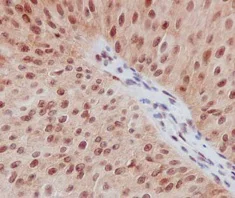 Immunohistochemistry (Formalin/PFA-fixed paraffin-embedded sections) - Anti-Smad2 (phospho S255) antibody [EPR2856(N)] (AB188334)