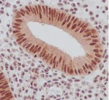 Immunohistochemistry (Formalin/PFA-fixed paraffin-embedded sections) - Anti-Smad2 (phospho S255) antibody [EPR2856(N)] (AB188334)