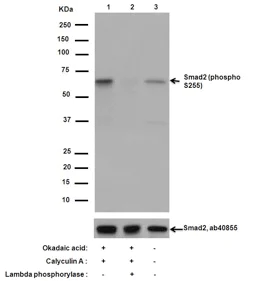 Western blot - Anti-Smad2 (phospho S255) antibody [EPR2856(N)] (AB188334)