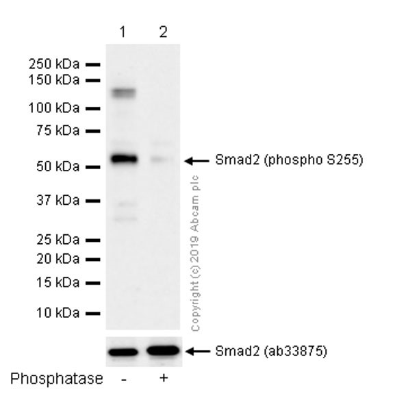 Anti-Smad2 (phospho S255) antibody [EPR2856(N)]