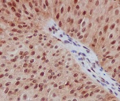 Immunohistochemistry (Formalin/PFA-fixed paraffin-embedded sections) - Anti-Smad2 (phospho S255) antibody [EPR2856(N)] - BSA and Azide free (AB219598)