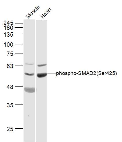 Western blot - Anti-Smad2 (phospho S465) antibody (AB216482)