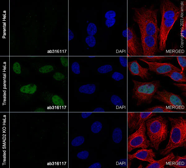 Immunocytochemistry/ Immunofluorescence - Anti-Smad2 (phospho S465 + S467) antibody [EPR28610-44] - BSA and Azide free (AB316118)
