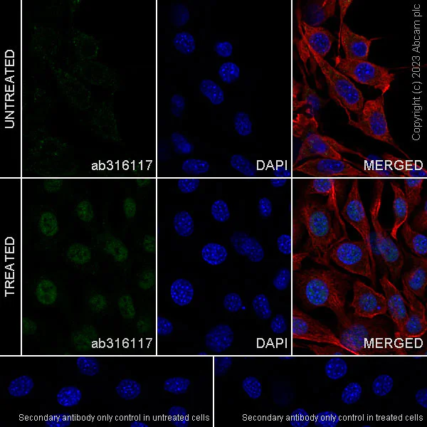 Immunocytochemistry/ Immunofluorescence - Anti-Smad2 (phospho S465 + S467) antibody [EPR28610-44] - BSA and Azide free (AB316118)
