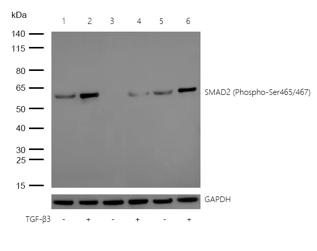 Western blot - Anti-Smad2 (phospho S465 + S467) antibody [SR4368] (AB326682)
