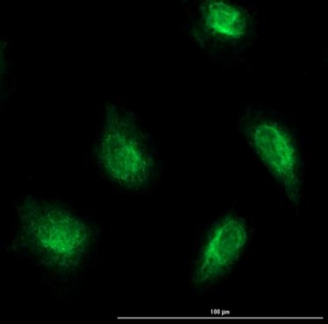 Immunocytochemistry/ Immunofluorescence - Anti-Smad2 (phospho S467) antibody (AB235265), expandable thumbnail