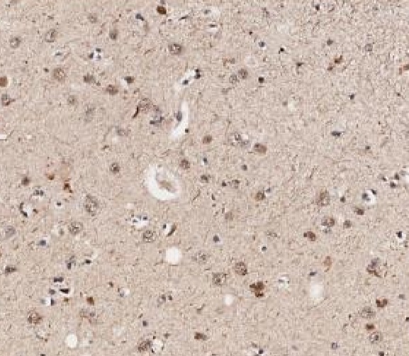 Immunohistochemistry (Formalin/PFA-fixed paraffin-embedded sections) - Anti-Smad2 (phospho S467) antibody (AB235265), expandable thumbnail