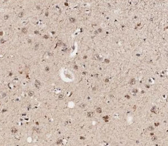 Immunohistochemistry (Formalin/PFA-fixed paraffin-embedded sections) - Anti-Smad2 (phospho S467) antibody (AB235265)